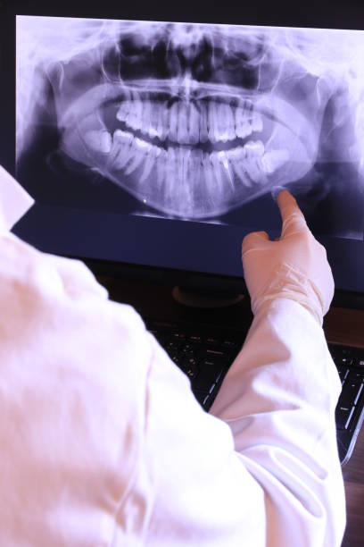 Best Emergency Dentist for Lost Fillings or Crowns in Plummer, ID